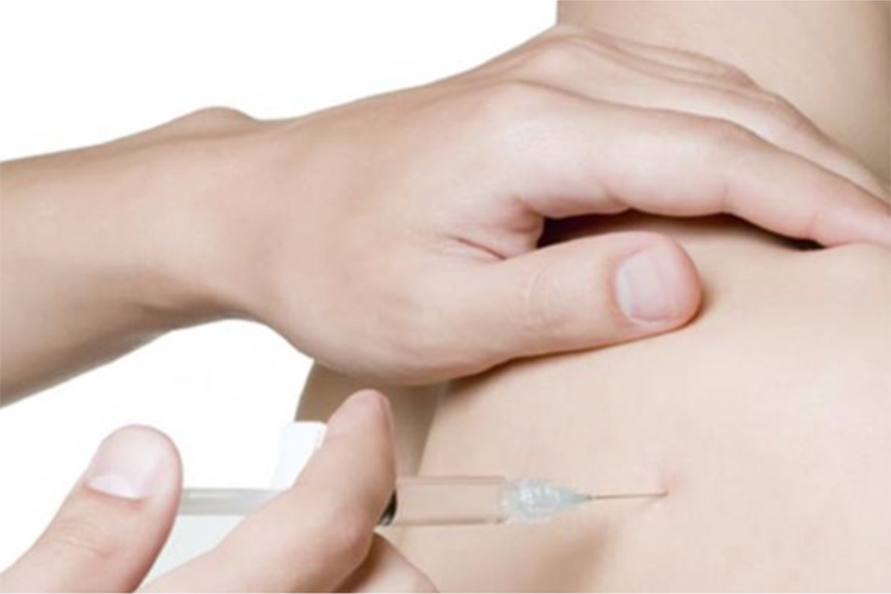 Trigger Point Injections