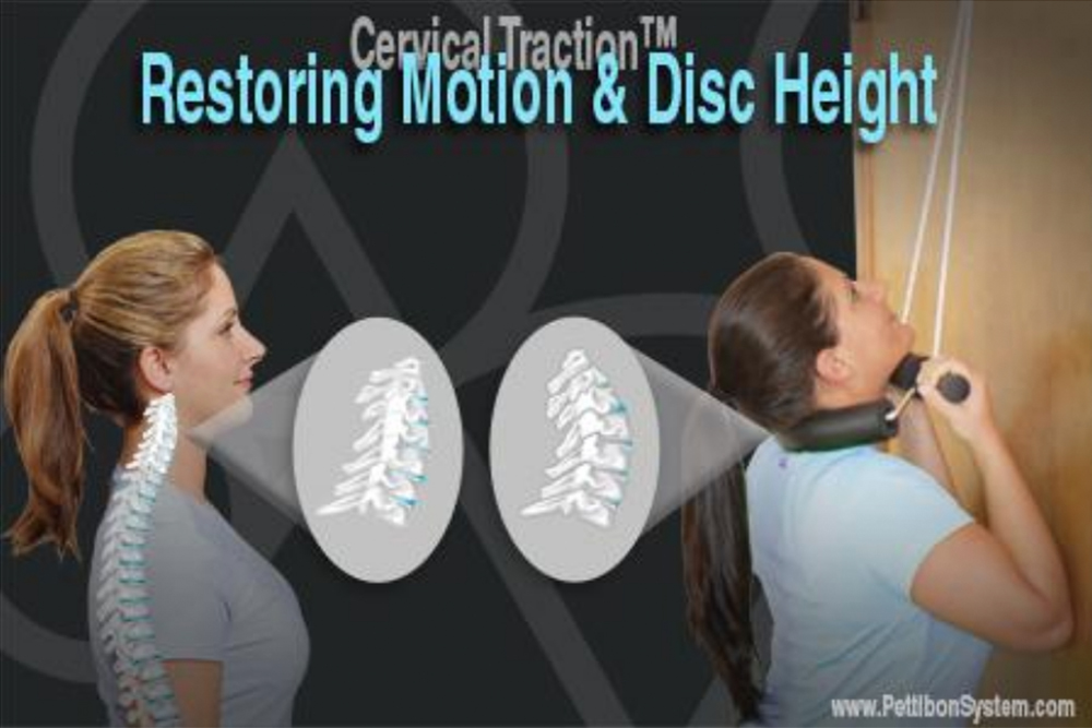 Restoring Motion & Disc Height